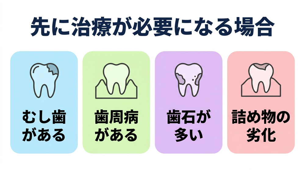 ホワイトニングの前に治療が必要になる場合として、むし歯・歯周病・歯石・詰め物の劣化の4つを示した図