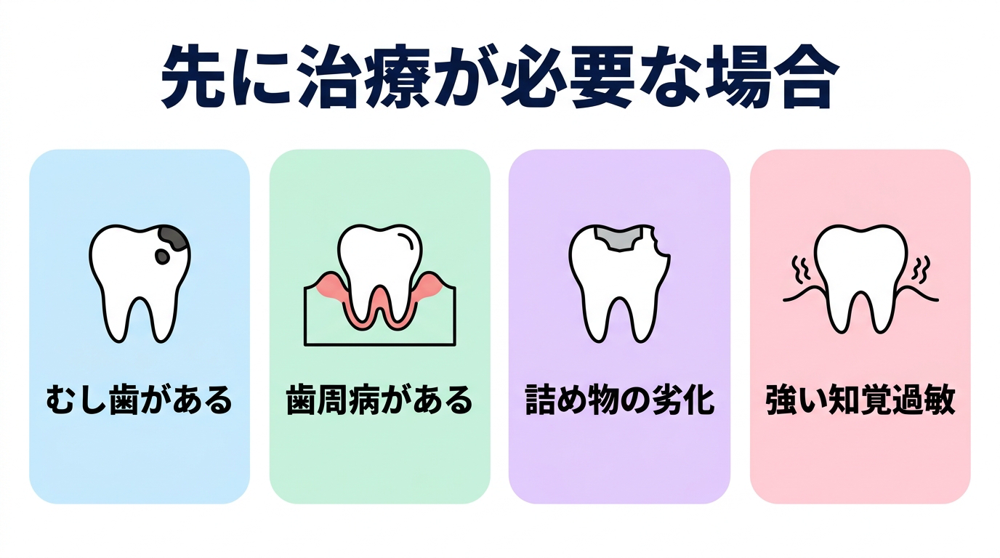 ホワイトニングの前に治療が必要な場合として、むし歯・歯周病・詰め物の劣化・強い知覚過敏の4つを示した図