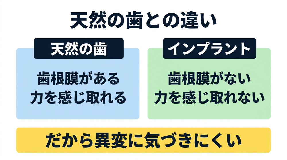 天然の歯には歯根膜があり力を感じ取れるが、インプラントには歯根膜がなく力を感じ取れないという違いを示した対比図