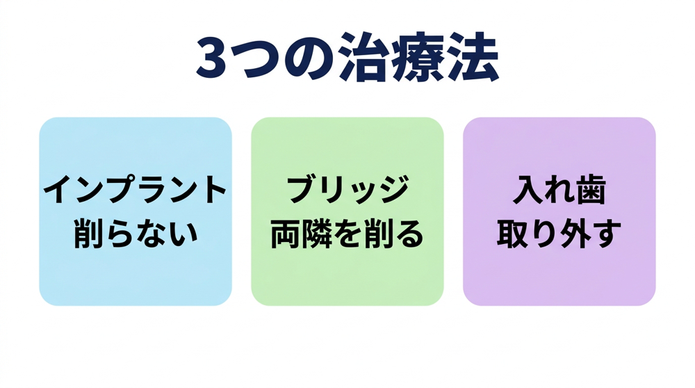 失った歯を補う方法として、周りの歯を削らないインプラント、両隣を削るブリッジ、取り外す入れ歯の3つを示した図